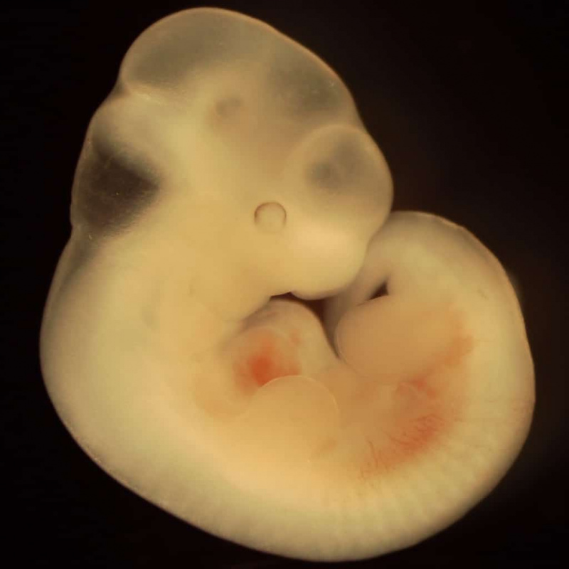   Mouse embryo, ika-11 araw ng pag-unlad